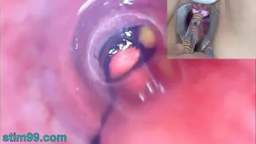 Mujer madura peehole endoscope camera video porn